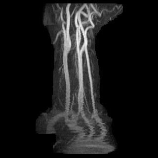 2021 MRA.59420009.46868241.jpg